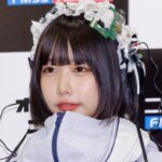 あのちゃん大丈夫？3ヶ月おきの大ケガに心配の声！事故の内容は？